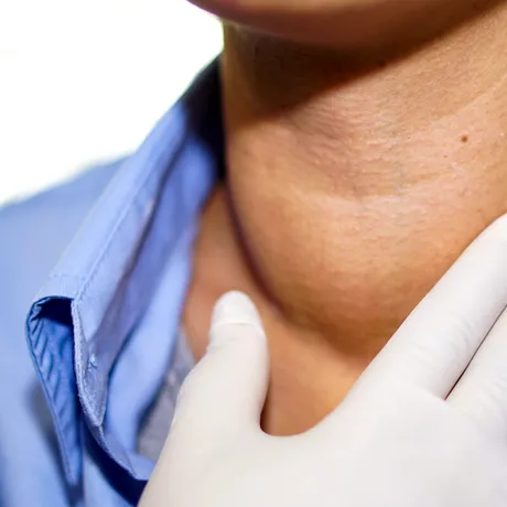 Noduli tiroidieni maligni – analizele care arată dacă sunt cancerigeni