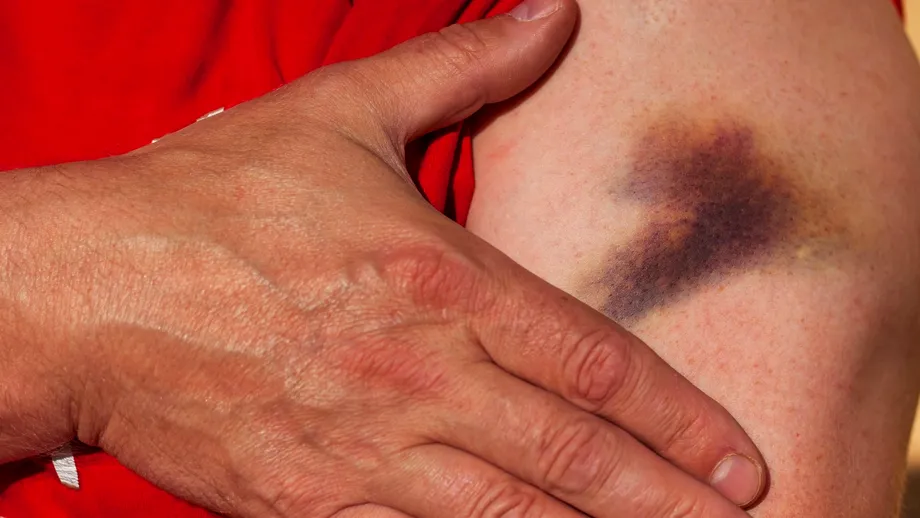 5 semne care pot indica o boală de sânge