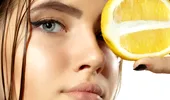 Mit sau adevăr – te scapă zeama de lămâie de acnee? Verdictul dermatologului