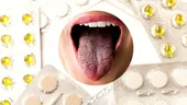 Medicamente care usucă gura, pătează dinții și ne lasă cu un gust metalic