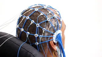 Semnul din timpul somnului asociat cu demența și Parkinson. Poate apărea cu ani înaintea diagnosticului