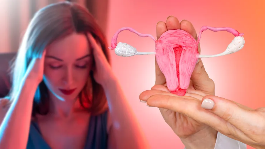 Legătura dintre endometrioză și cancerul ovarian. Ce simptome recomandă medicii să urmărești