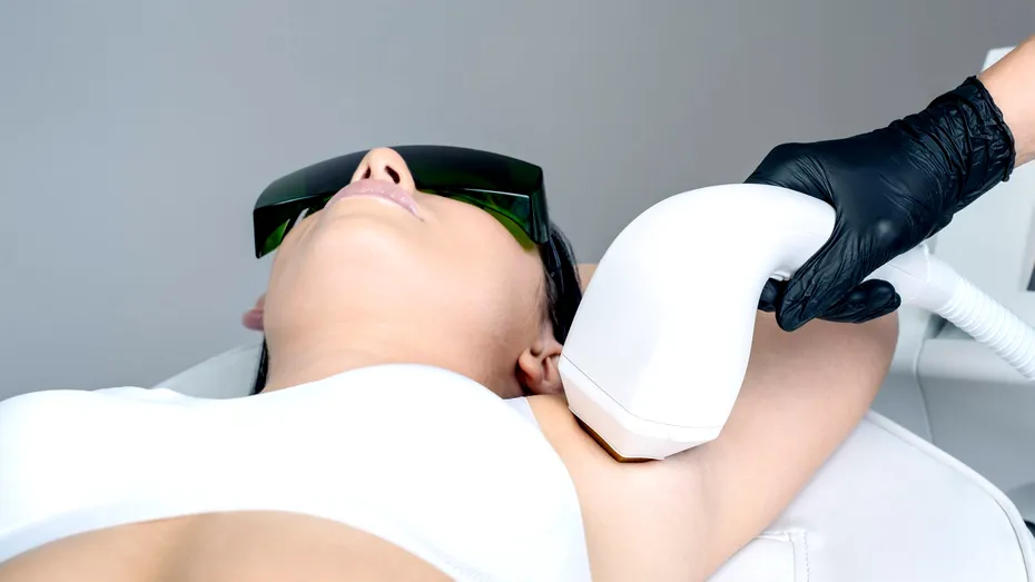 Epilarea cu laser: 7 mituri și adevăruri