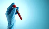 O grupă sangvină, potențial factor de risc pentru cancerul de sân
