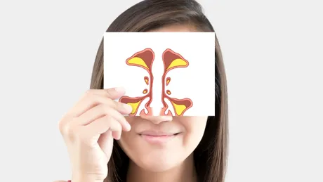 Deviaţie de sept nazal: cauze, simptome, tratament