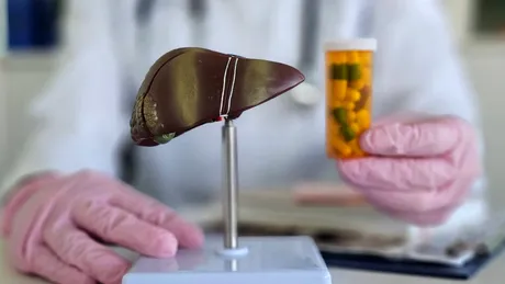 Când avem nevoie de suplimentele hepatice și în ce situații NU trebuie să folosim hepatoprotectoarele