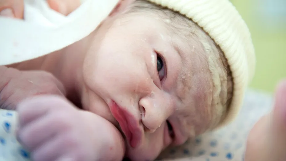 Boala hemolitica a nou-nascutului prin incompatibilitate de grup ABO: cauze, simptome, complicatii, analize, tratament