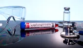 Leptospiroza: boala bacteriană care poate apărea după contactul cu apă contaminată. Cum se transmite, ce simptome are și cum poate fi prevenită