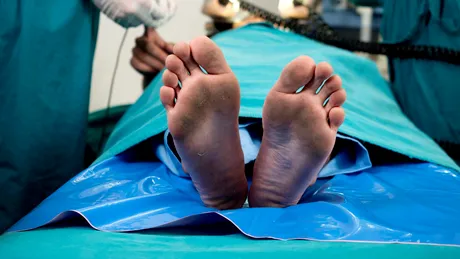 Povestea fabuloasă a pacientului declarat mort care s-a trezit la spital, câteva ore mai târziu. Medicii: 