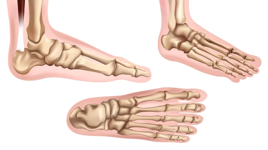 Neuromul Morton: cauze, simptome, opțiuni de tratament