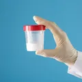 Poate o spermogramă realizată acasă să indice fertilitatea masculină?