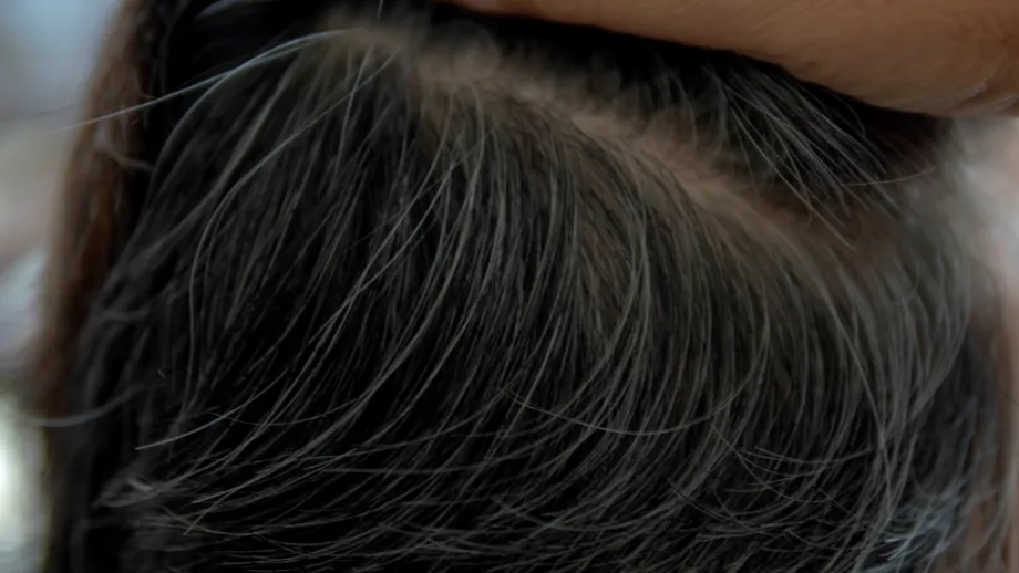Mit sau realitate: crește mai mult păr dacă smulgi un fir alb? Ce spun specialiștii