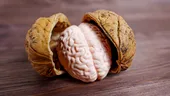 Prof. Vlad Ciurea dezvăluie alimentele care ajută creierul să funcționeze mai bine. „Beți apă. Creierul este 78% apă”