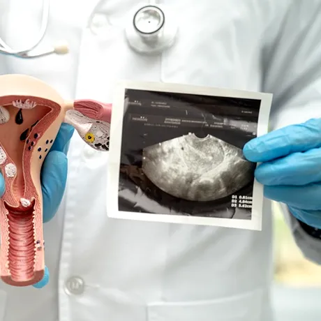 Obiceiul ZILNIC care poate crește riscul de a suferi de cancer la vezică urinară