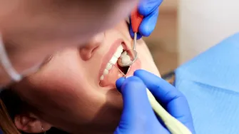 Dacă nu te dor dinții, asta nu înseamnă că nu ai putea avea probleme cu dantura. Ce poți descoperi la un simplu control!