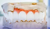 (P) Estetică fără compromis: De ce implantul dentar e cea mai naturală soluție