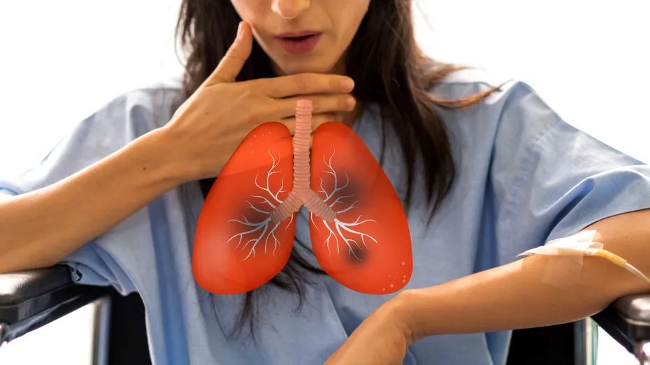 Boala cauzată de poluare care bagă mii de români în spital. Medic: „1 din 4 pacienți cu această afecțiune dezvoltă cancer pulmonar”