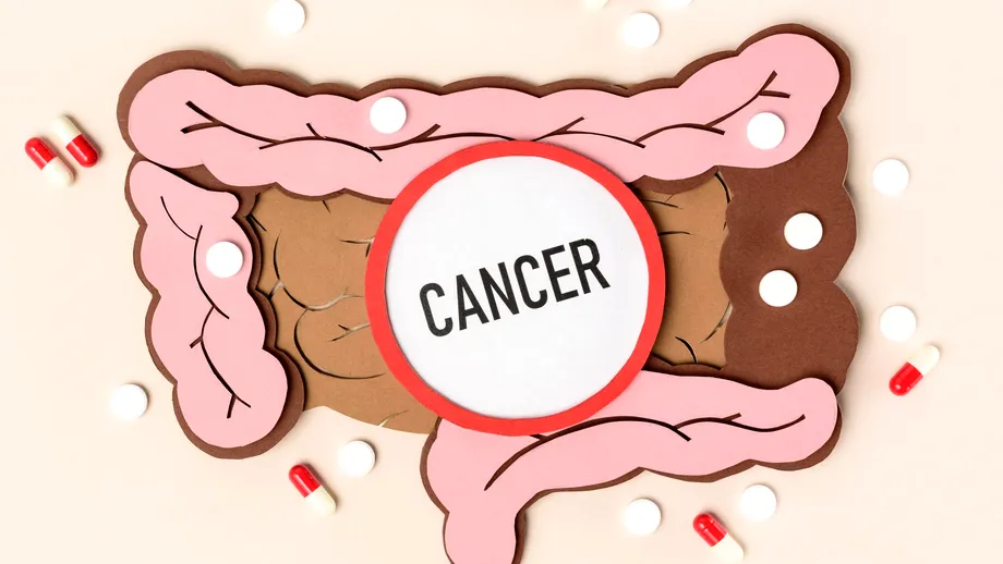 4 boli care cresc riscul de cancer de colon. Ce analize se fac preventiv