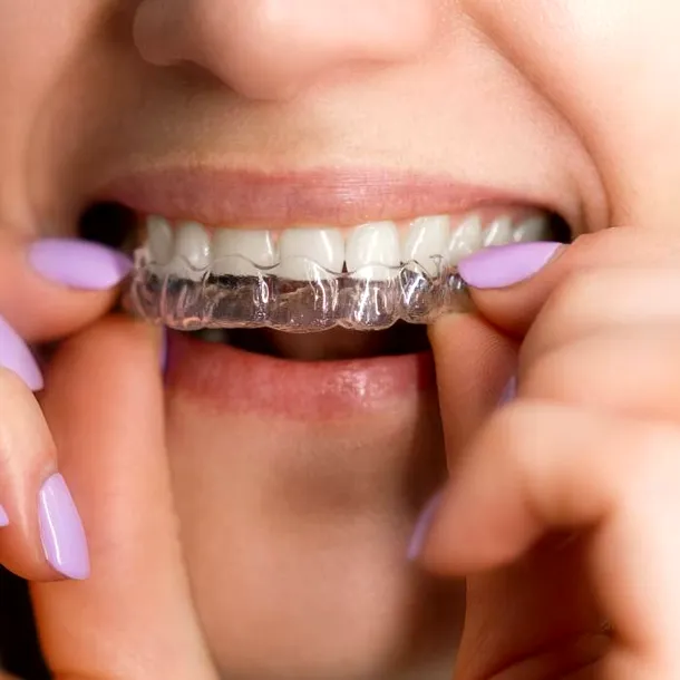 Ortodonția în 2025 – nu mai e ce era: fără brackets, fără metal, fără vizite lunare. Simplu, dar eficient, în același timp