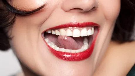 5 cauze ale căderii dinţilor