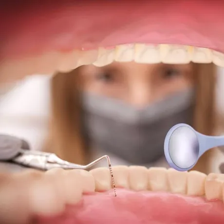 Când se scot măselele de minte: ghid complet explicat de medicul stomatolog dr. Alin Gabor