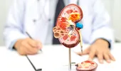 Boala de rinichi poate evolua ani întregi fără simptome. Două analize simple o pot depista din timp