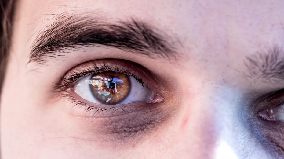 Excesele se văd pe față! 5 semne că faci abuz de zahăr, alcool, carne sau lactate