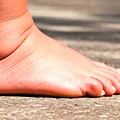 De ce ți se umflă picioarele vara? Când căldura este de vină și când edemul poate ascunde o problemă de sănătate