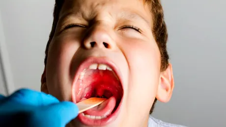 Copilul are episoade dese de „roșu în gât”? Rapid la medicul ORL, poate avea amigdalele inflamate!