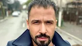 Alexandru Constantin, totul despre reușita implantulului de păr: 