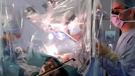 VIDEO O femeie de 53 de ani cântă la vioară în timpul unei operaţii pe creier