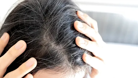 Adio fire albe! Serul negru care oprește albirea și accelerează creșterea părului