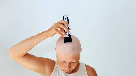 Cum previi sau ameliorezi 5 reacții adverse comune cauzate de chimioterapie 