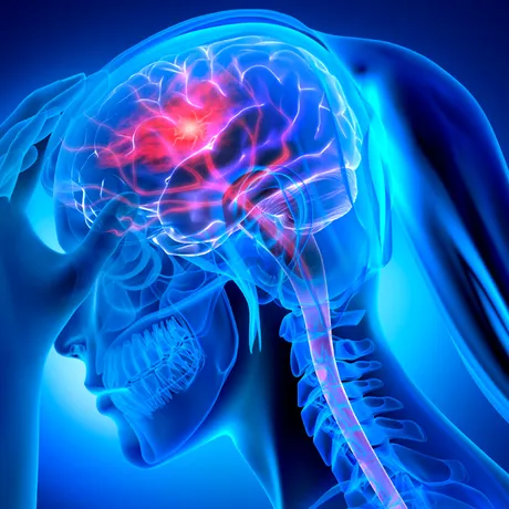 Atenție! Băutura „populară” asociată cu un risc mult mai mare de demență și accident vascular cerebral