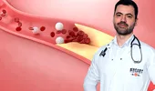 Ce trebuie să facem pentru a ne „desfunda” vasele de sânge, potrivit medicului primar cardiolog Ștefan Busnatu