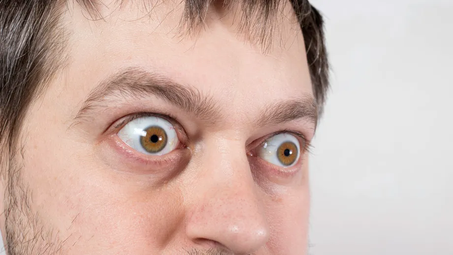 8 boli care ți se citesc în privire. Ce semne dau ochii când ai un AVC sau probleme cu ficatul ori tiroida