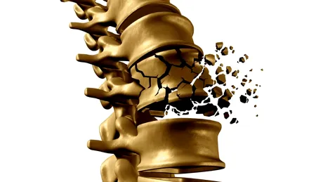 Osteonecroza (infarctul osos): cauze, simptome, tratament