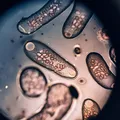 Cum să faci o curățare eficientă a paraziților intestinali