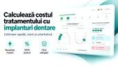 (P) De la implant la dintele final: tehnologia care explică opțiunile și costurile