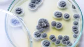 O ciupercă periculoasă, rezistentă la medicamente, se răspândește rapid în spitale. Poate provoca infecții grave