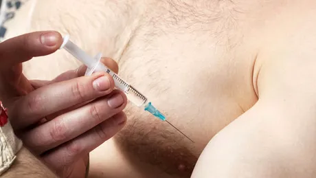 18 luni s-a injectat cu spermă. Află de ce a apelat un bărbat la această metoda bizară!