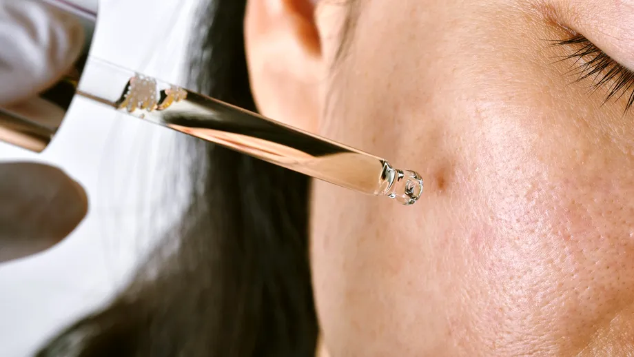 Cum ții sub control tenul gras și excesul de sebum