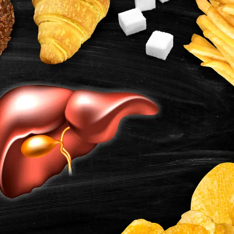 9 factori care îți pot distruge ficatul, chiar dacă nu bei alcool. Avertismentul medicilor