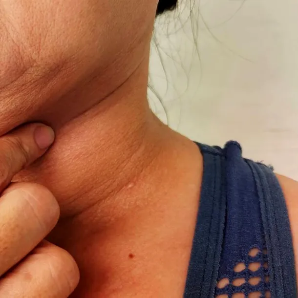 Exercițiul simplu care te scapă de bărbia dublă. Îl poți face zilnic acasă