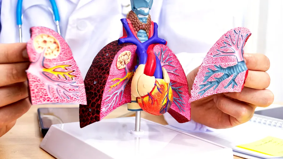 Avertismentul medicilor: Pneumonia este prima dintre cauzele infecțioase de deces!