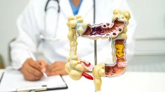 Semnal de alarmă: Creșterea alarmantă a cazurilor de cancer colorectal la tineri