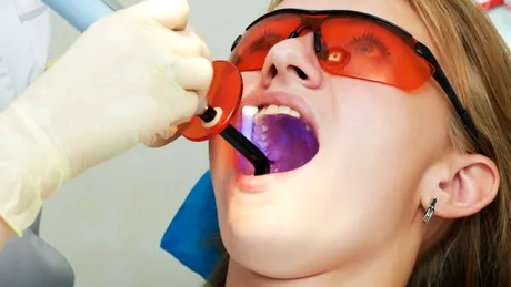 Dinţii cariaţi ar putea fi reparaţi cu ajutorul celulelor stem
