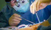 Premieră mondială: malformaţie congenitală cardiacă complexă rezolvată endoscopic în România