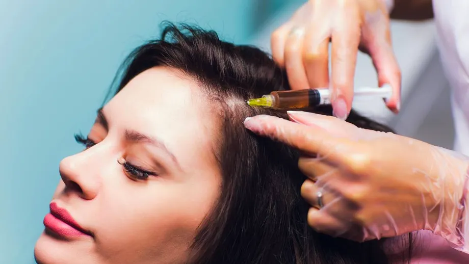 Cum funcționează mezoterapia pentru piele și scalp