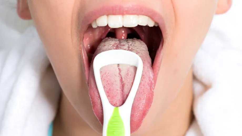 Ce este sindromul gurii care arde? Apare la menopauză